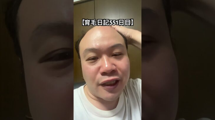 【育毛日記551日目】荒野行動の大会いってきます #実況 #日記 #育毛 #荒野行動 #配信