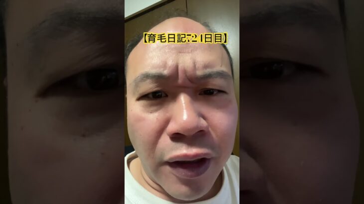 【育毛日記724日目】前髪欲しいのに #実況 #日記 #毛バリ #育毛 #www #ゲーム実況 #荒野行動 #いぶにぃチャンネル